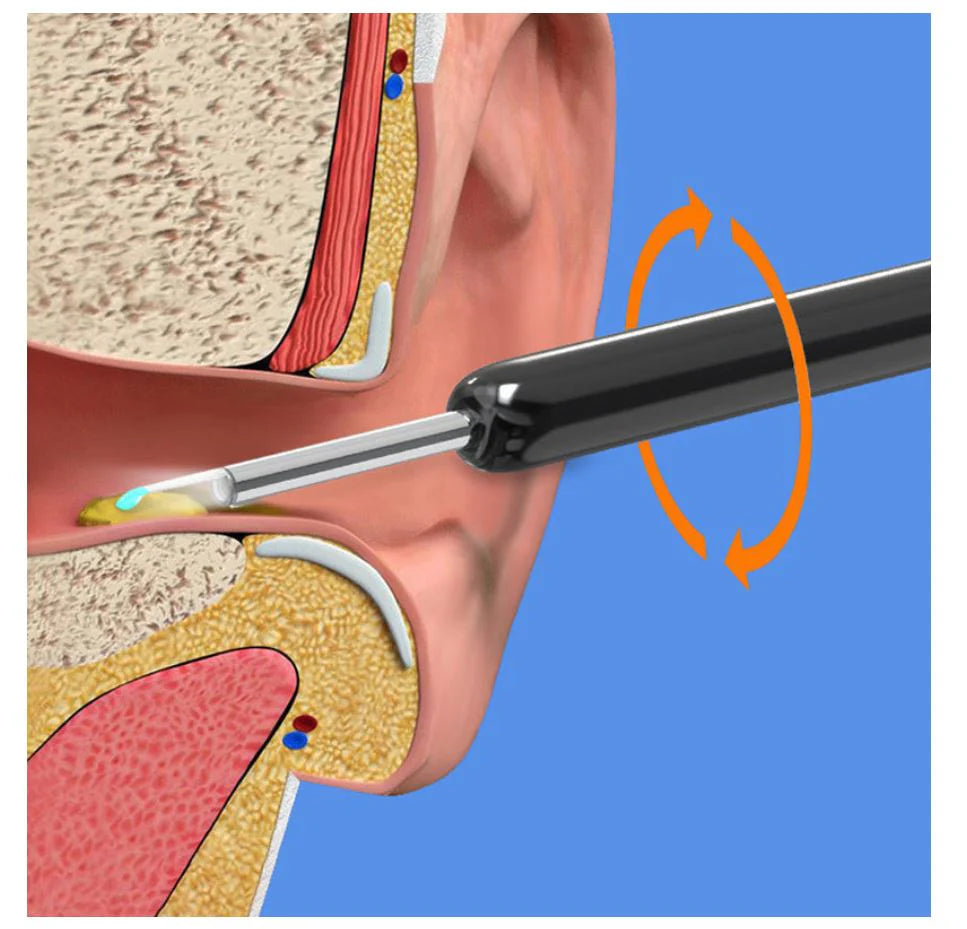 WM EarCare Pro