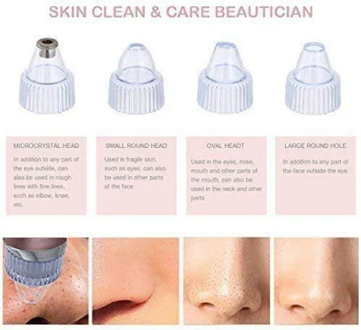 Blackhead Remover Vacuum